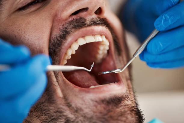 Best Emergency Dental Care for Broken or Chipped Teeth in West Haven, CT